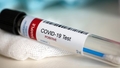 Covid-19 Latvijā: atklāti 236 jauni inficēšanās gadījumi