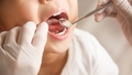 Valsts apmaksātajā bērnu zobārstniecībā ieviesti divi būtiski jaunumi