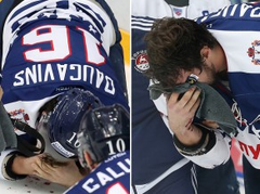 Video: KHL nedēļas uzbrucējs Daugaviņš gūst savainojumu