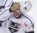 "Blackhawks" sagrauj "Penguins", Iginla no Kalgari atvadās ar asiņainu kautiņu