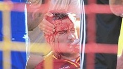 Димидко разбил голову в контрольном матче "Арсенала" (18+)